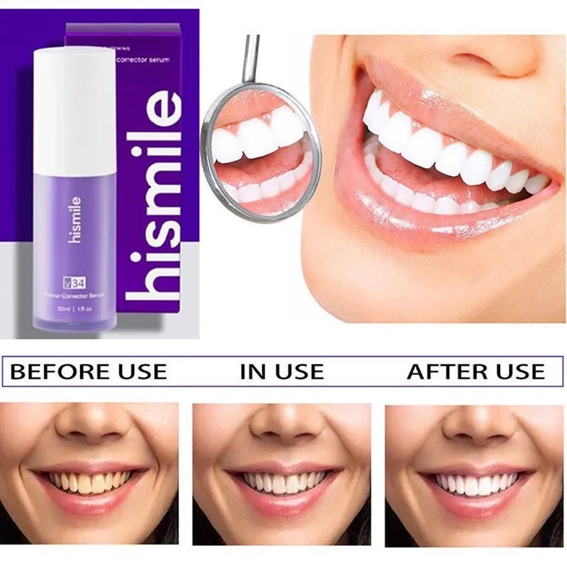 V34-Hismile-Toothpaste-Whitening.jpg